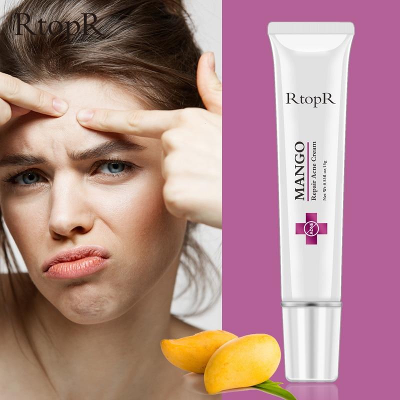 Acne Treatment Blackhead Repair Whitening Moisturizer - MakenShop